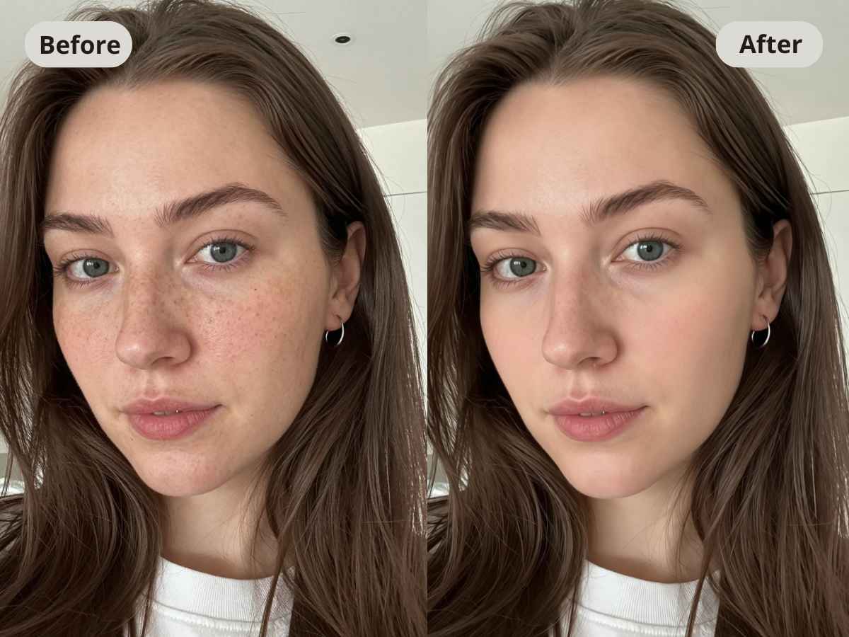 Using magic eraser online free to automatically remove skin blemishes on a face